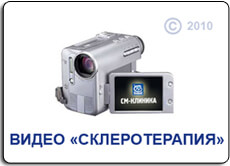 Склеротерапия