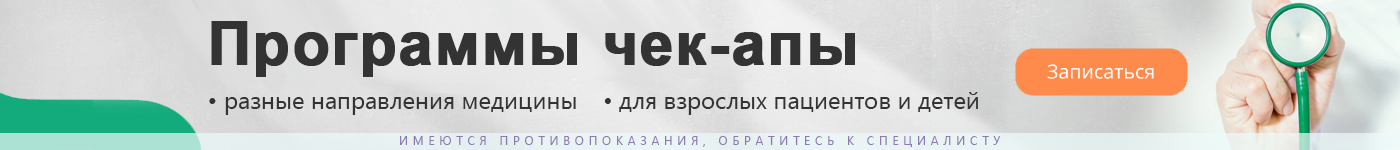 ЧЕКАПЫ