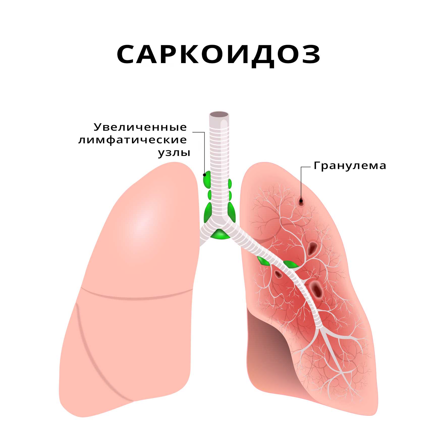 Причины возникновения