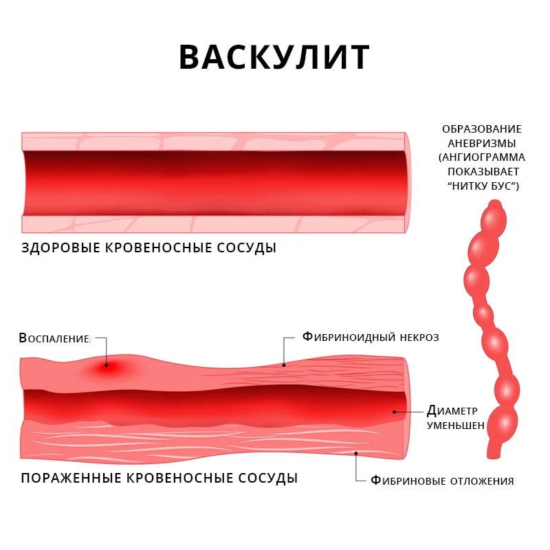 Причины возникновения