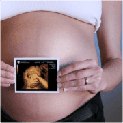 Узи 34 недели беременности спб