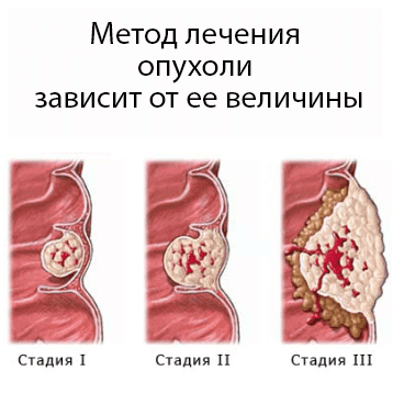 widgetkit image