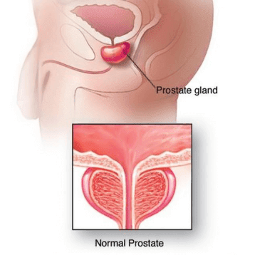 imunolog prostatita inflamația prostatitei la bărbați