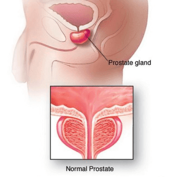 imunolog prostatita)