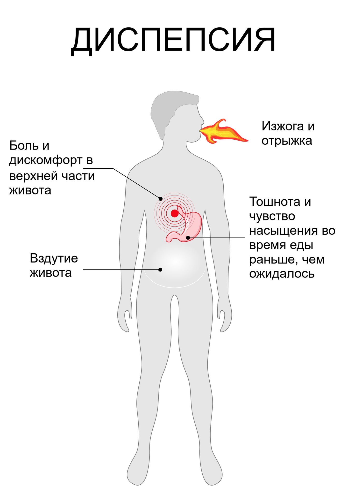 Клиническая картина диспепсии Клиническая картина диспепсии