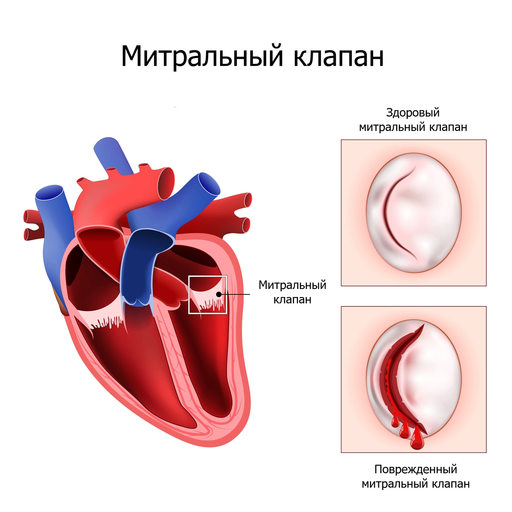 Патогенез