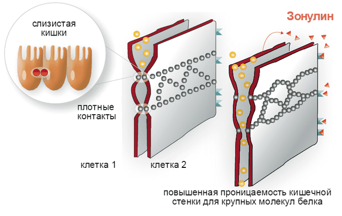 Анализ кала на зонулин