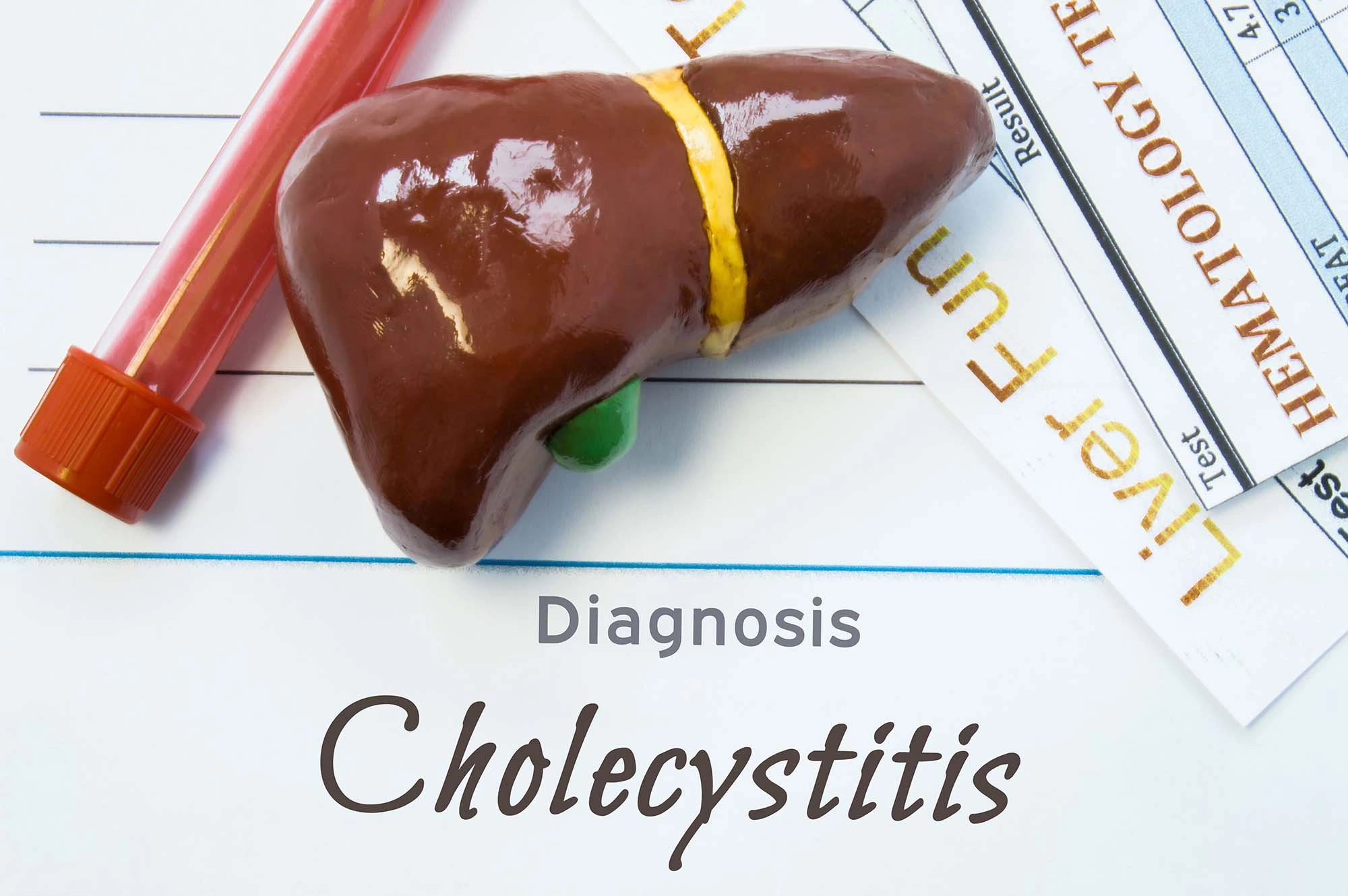 Острый холецистит: симптомы, признаки, диагностика, осложнения, лечение