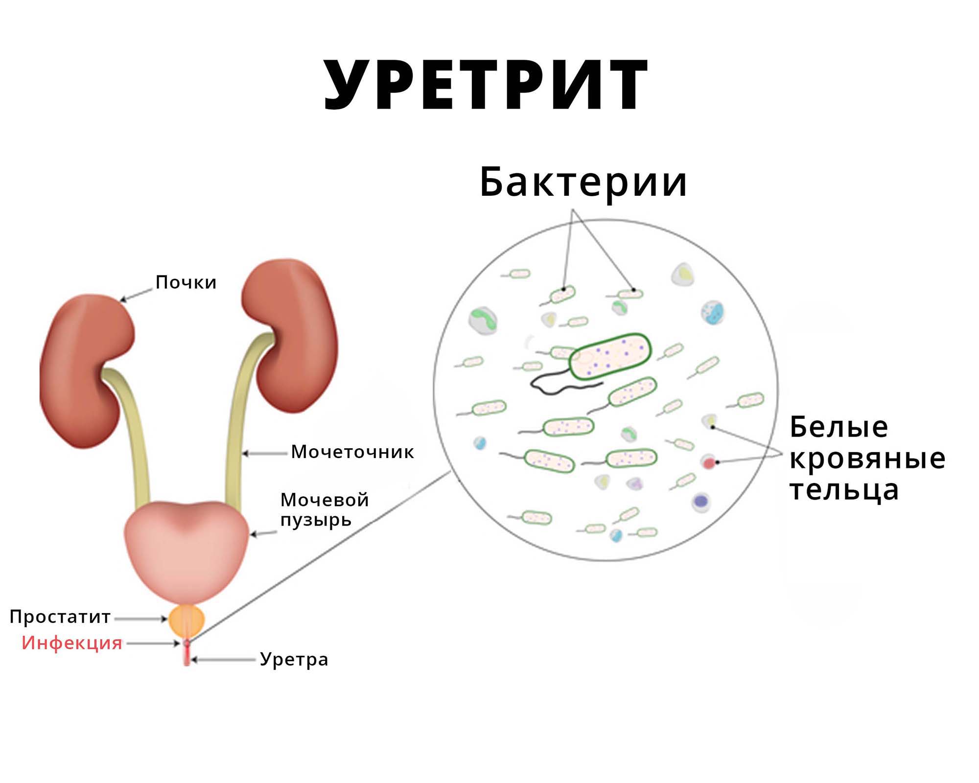 Причины