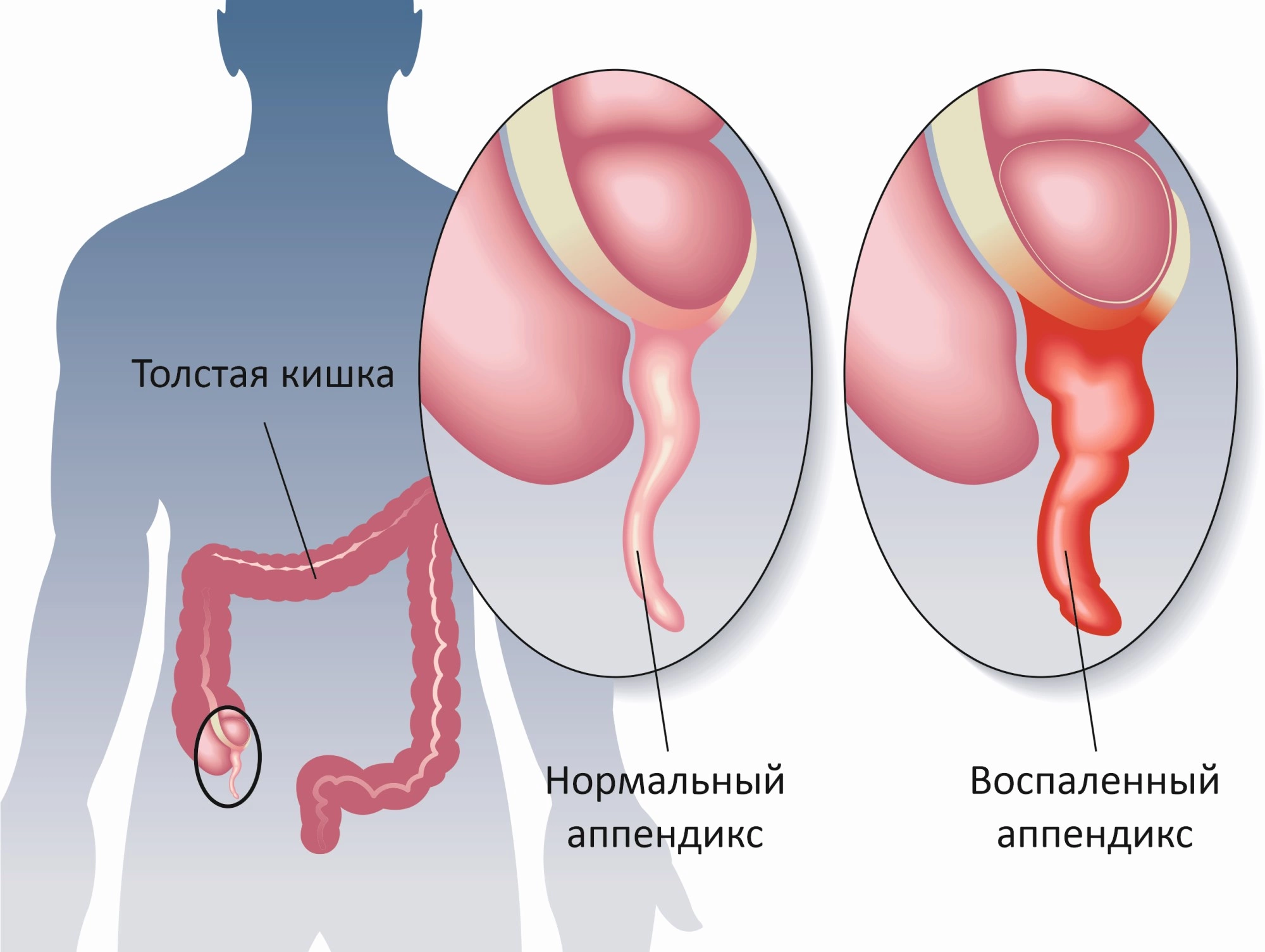 Повышение температуры тела