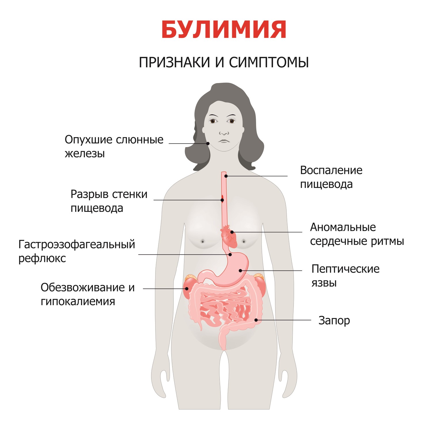 Булимия