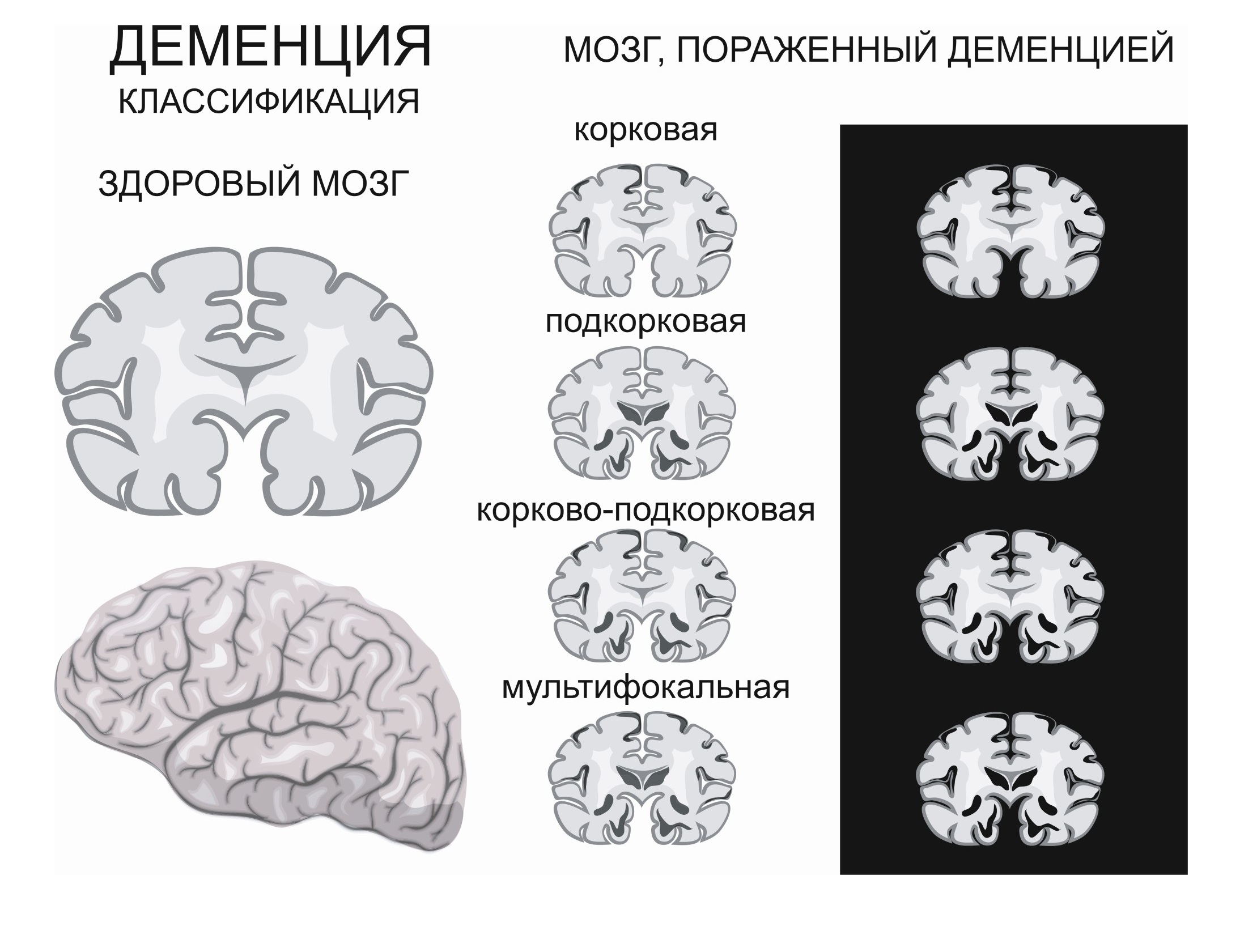 Деменция у кошек