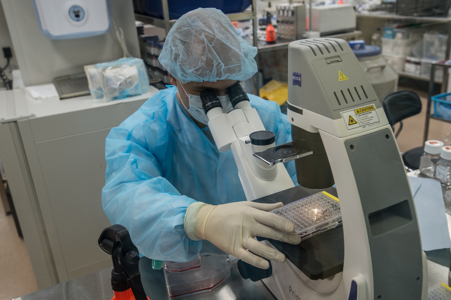 Геморрагической лихорадка с почечным синдромом