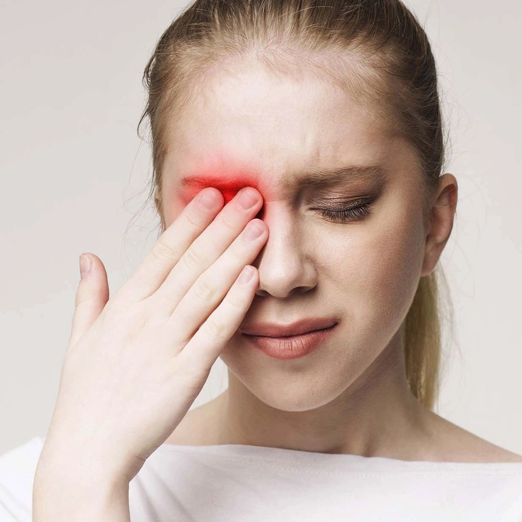 Конъюнктивит: причины, симптомы, признаки, осложнения, лечение ...