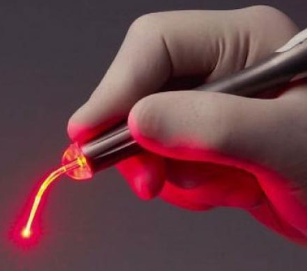 Лазерное лечение анальной трещины
