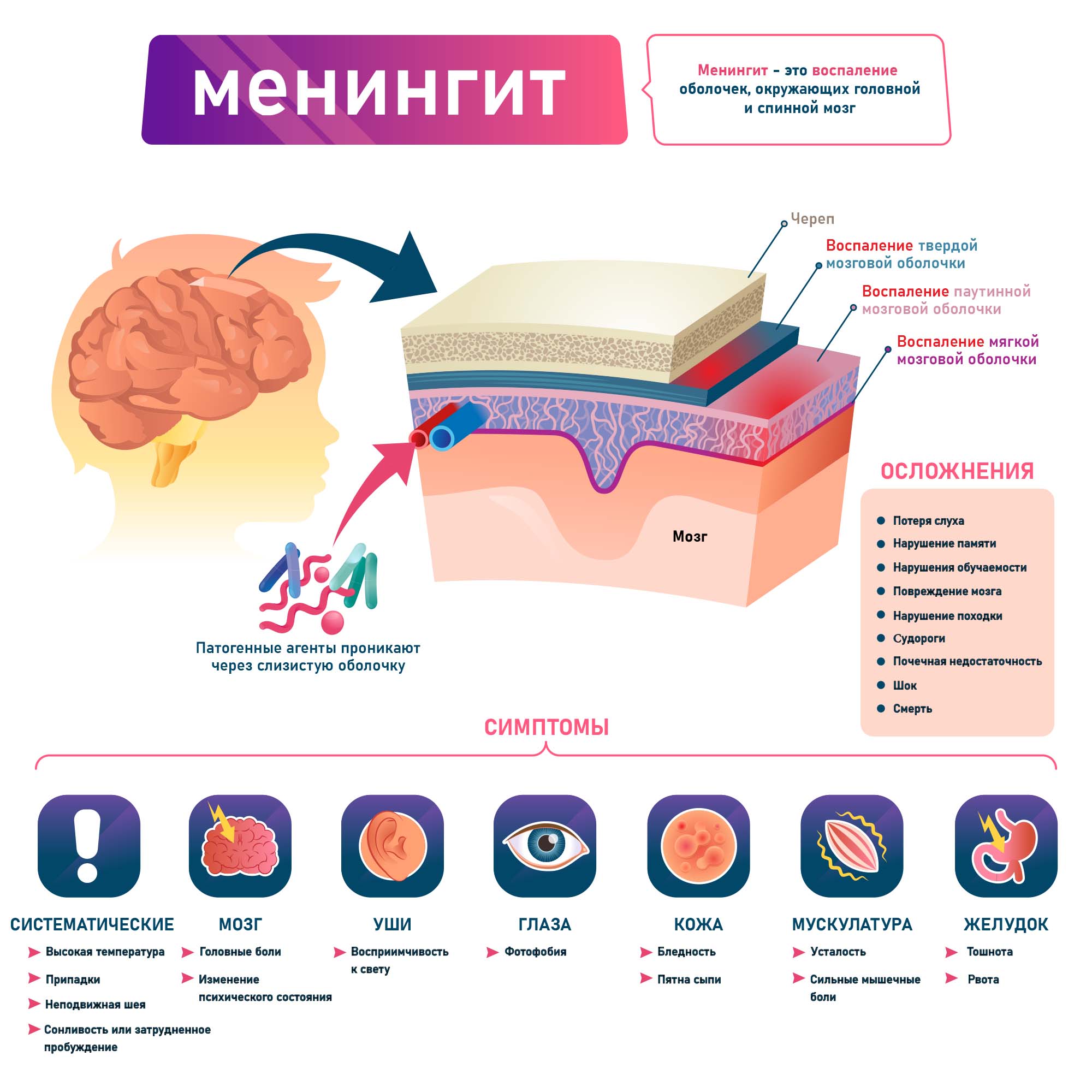 Менингит