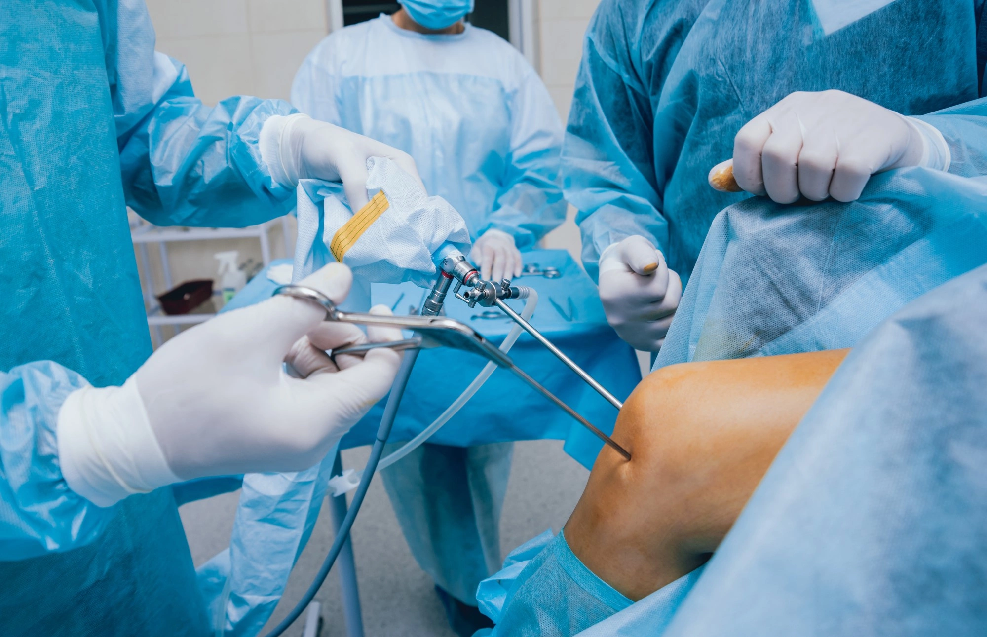 Артроскопия коленного сустава это. Артроскопия коленного сустава в Euromed Clinic Артроскопия коленного сустава в Германии - Цена артроскопии колена в. Артроскопия коленного сустава: задали врачу 9 вопросов о процедуре.