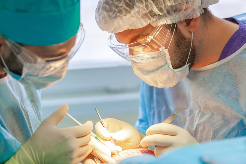 Пересадка волос в СПб: цена трансплантации волос