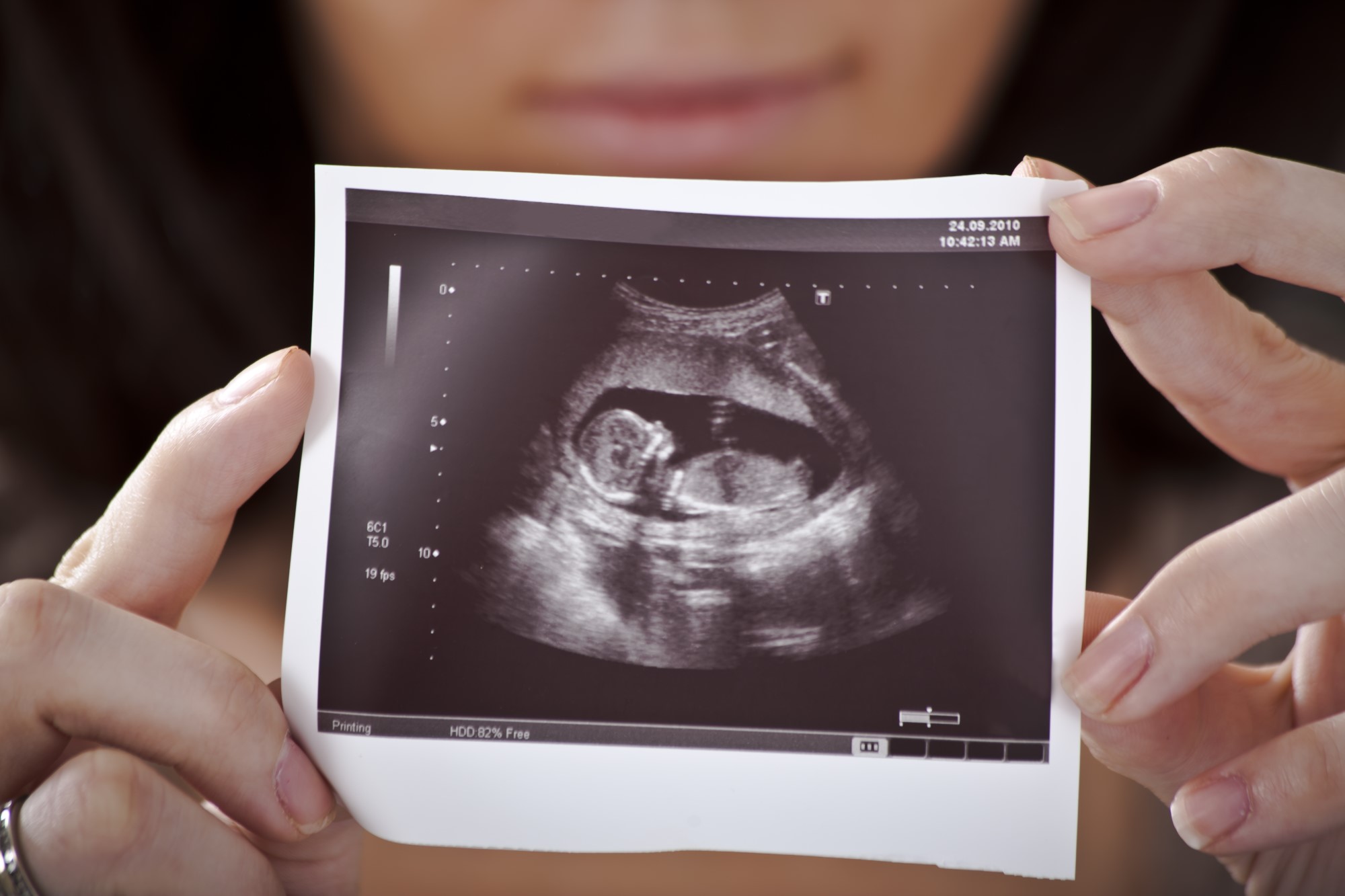 Скрининг УЗИ 3 триместра беременности