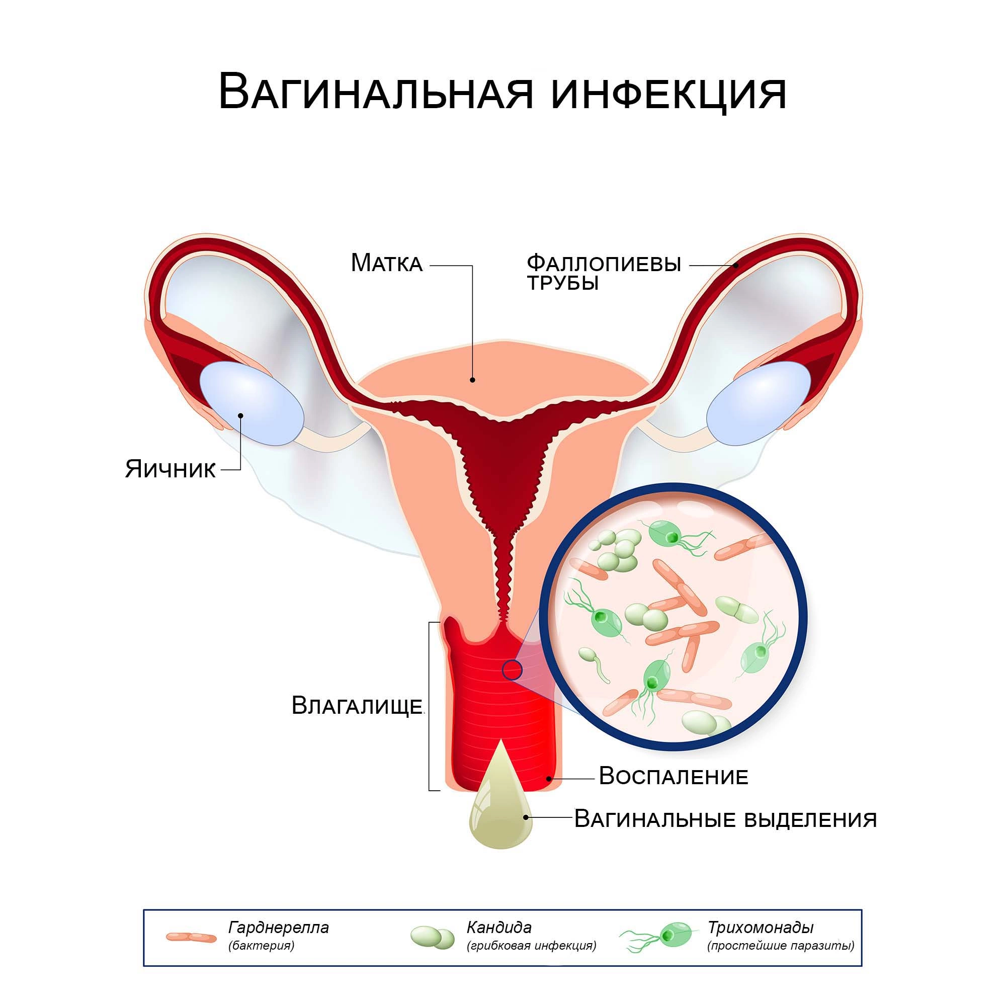 Причины вульвита у детей