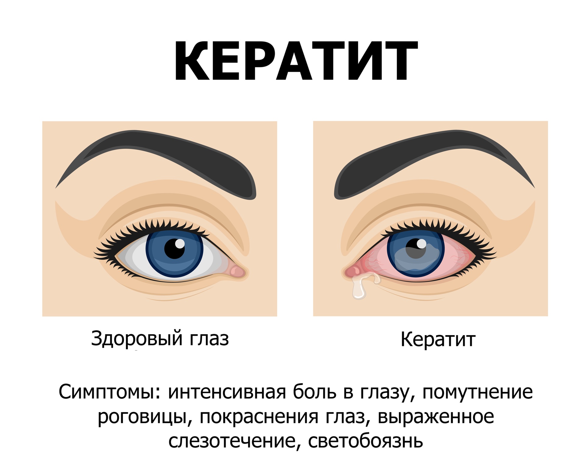 Первые клинические признаки Первые клинические признаки