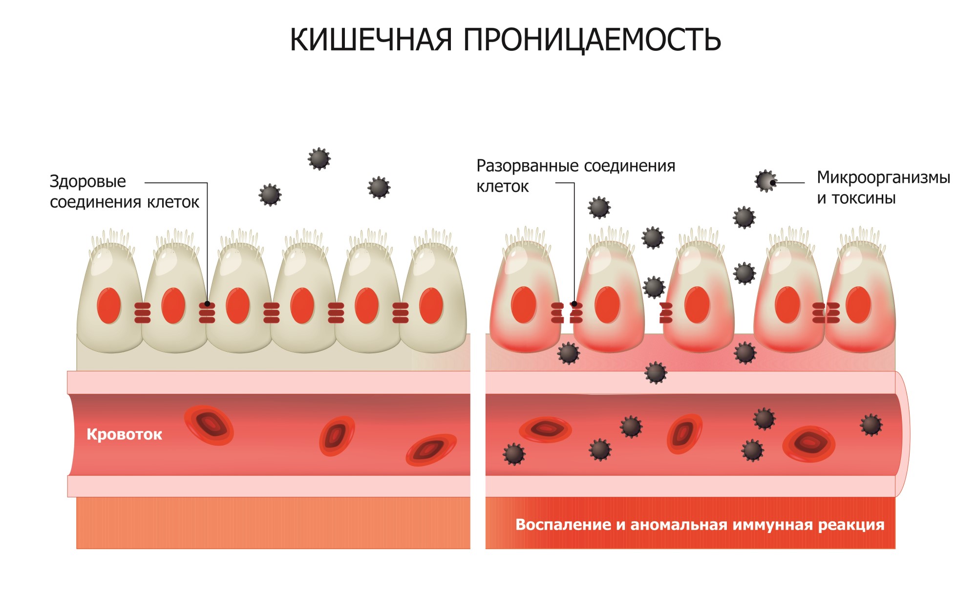 Анализ кала на зонулин