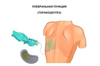 Правильное выполнение перевязки помогает ускорять выздоровление.